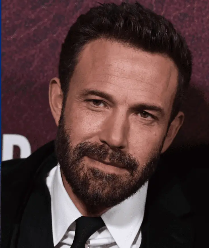 Ben Affleck después del implante capilar