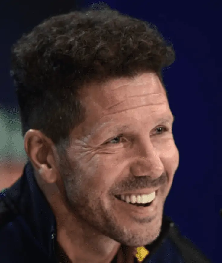 diego simeone Despues del implante capilar