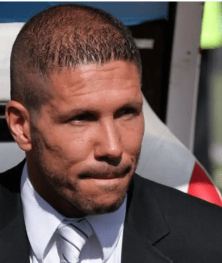 diego simeone antes del implante capilar