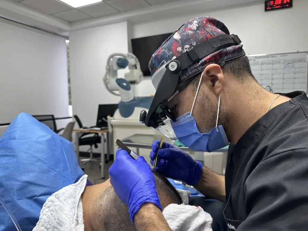 injerto capilar profesional medico